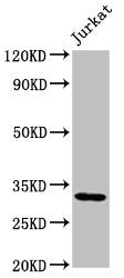 Western Blot  | Positive WB detected in: Jurkat whole cell lysate  | All lanes: PSMG1 antibody at 2µg/ml  | Secondary  | Goat polyclonal to rabbit IgG at 1/50000 dilution  | Predicted band size: 33, 31 kDa  | Observed band size: 33 kDaRabbit anti-Human PSMG1 Polyclonal Antibody