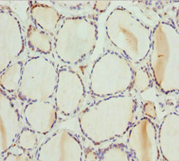 Immunohistochemistry of paraffin-embedded human thyroid tissue using PSPH Antibody at dilution of 1:100