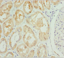 Immunohistochemistry of paraffin-embedded human kidney tissue using PSPH Antibody at dilution of 1:100