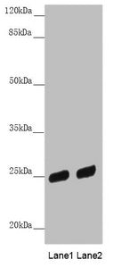Western blot  | All lanes: PSPH antibody at 3.81µg/ml  | Lane 1: HL60 whole cell lysate  | Lane 2: A431 whole cell lysate  | Secondary  | Goat polyclonal to rabbit IgG at 1/10000 dilution  | Predicted band size: 25 kDa  | Observed band size: 25 kDa