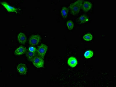 Immunofluorescent analysis of A431 cells using PTAFR Antibody at dilution of 1:100 and Alexa Fluor 488-congugated AffiniPure Goat Anti-Rabbit IgG(H+L)Rabbit anti-Human PTAFR Polyclonal Antibody