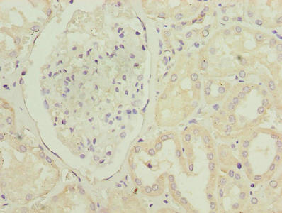 Immunohistochemistry of paraffin-embedded human kidney tissue using PTAFR Antibody at dilution of 1:100Rabbit anti-Human PTAFR Polyclonal Antibody
