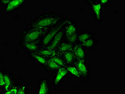 Immunofluorescent analysis of Hela cells using PTF1A Antibody at dilution of 1:100 and Alexa Fluor 488-congugated AffiniPure Goat Anti-Rabbit IgG(H+L)Rabbit anti-Human PTF1A Polyclonal Antibody