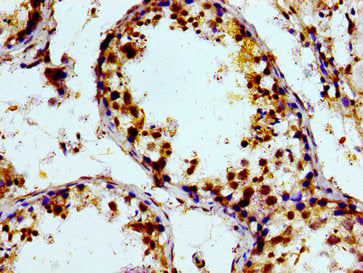Immunohistochemistry of paraffin-embedded human testis tissue using PTGR2 Antibody at dilution of 1:100Rabbit anti-Human PTGR2 Polyclonal Antibody