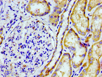 Immunohistochemistry of paraffin-embedded human kidney tissue using PTGR2 Antibody at dilution of 1:100Rabbit anti-Human PTGR2 Polyclonal Antibody