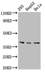 Western Blot  | Positive WB detected in: 293 whole cell lysate, HepG2 whole cell lysate, Hela whole cell lysate  | All lanes: PTGR2 antibody at 3.4µg/ml  | Secondary  | Goat polyclonal to rabbit IgG at 1/50000 dilution  | Predicted band size: 39, 20 kDa  | Observed band size: 39 kDaRabbit anti-Human PTGR2 Polyclonal Antibody