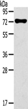 Gel: 8%SDS-PAGE,Lysate: 40 μg,,Primary antibody: NOX3 Antibody(NOX3 Antibody) at dilution 1/200 dilution,Secondary antibody: Goat anti rabbit IgG at 1/8000 dilution,Exposure time: 40 secondsRabbit anti-Human NOX3 Polyclonal Antibody