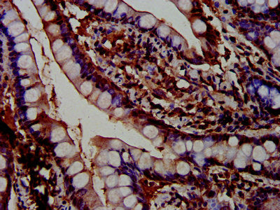 IHC image of PTPN3 Antibody diluted at 1:600 and staining in paraffin-embedded human small intestine tissue performed on a Leica BondTM system. After dewaxing and hydration, antigen retrieval was mediated by high pressure in a citrate buffer (pH 6.0). Section was blocked with 10% normal goat serum 30min at RT. Then primary antibody (1% BSA) was incubated at 4°C overnight. The primary is detected by a biotinylated secondary antibody and visualized using an HRP conjugated SP system.Rabbit anti-Human PTPN3 Polyclonal Antibody