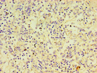 Immunohistochemistry of paraffin-embedded human spleen tissue using PTPN5 Antibody at dilution of 1:100Rabbit anti-Human PTPN5 Polyclonal Antibody