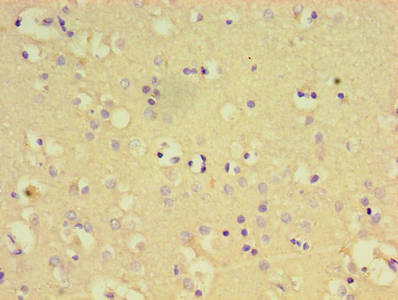 Immunohistochemistry of paraffin-embedded human brain tissue using PTPN5 Antibody at dilution of 1:100Rabbit anti-Human PTPN5 Polyclonal Antibody