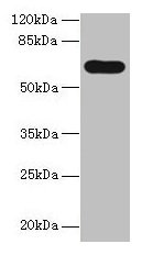 Western blot  | All lanes: PTPN5 antibody at 12µg/ml + HepG2 whole cell lysate  | Secondary  | Goat polyclonal to rabbit IgG at 1/10000 dilution  | Predicted band size: 64, 61 kDa  | Observed band size: 64 kDaRabbit anti-Human PTPN5 Polyclonal Antibody
