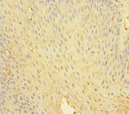 Immunohistochemistry of paraffin-embedded human tonsil tissue using PTPN6 Antibody at dilution of 1:100Rabbit anti-Human PTPN6 Polyclonal Antibody