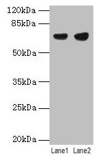 Western blotAll lanes: PTPN6 antibody at 12µg/mlLane 1: Jurkat whole cell lysateLane 2: Raji whole cell lysateSecondaryGoat polyclonal to rabbit IgG at 1/10000 dilutionPredicted band size: 68, 64, 71 kDaObserved band size: 68 kDaRabbit anti-Human PTPN6 Polyclonal Antibody