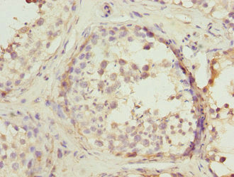 Immunohistochemistry of paraffin-embedded human testis tissue using PTPRE Antibody at dilution of 1:100Rabbit anti-Human PTPRE Polyclonal Antibody