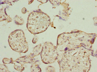 Immunohistochemistry of paraffin-embedded human placenta tissue using PTPRE Antibody at dilution of 1:100Rabbit anti-Human PTPRE Polyclonal Antibody