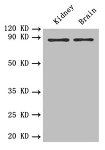 Western blotAll lanes: PTPRE antibody at 0.6 μg/mlLane 1: Mouse kidney tissueLane 2: Mouse brain tissueSecondaryGoat polyclonal to rabbit IgG at 1/10000 dilutionPredicted band size: 81, 75, 72 kDaObserved band size: 81 kDaRabbit anti-Human PTPRE Polyclonal Antibody