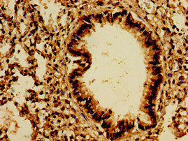 Immunohistochemistry of paraffin-embedded human lung tissue using the antibody at dilution of 1:100Rabbit anti-Human PTPRF Polyclonal Antibody