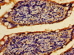 Immunohistochemistry of paraffin-embedded human small intestine tissue using PTPRF Antibody at dilution of 1:100Rabbit anti-Human PTPRF Polyclonal Antibody