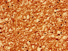 Immunohistochemistry of paraffin-embedded human brain tissue using the antibody at dilution of 1:100Rabbit anti-Human PTPRZ1 Polyclonal Antibody