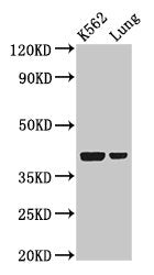 Western Blot  | Positive WB detected in: K562 whole cell lysate, Rat lung tissue  | All lanes: PTX3 antibody at 2µg/ml  | Secondary  | Goat polyclonal to rabbit IgG at 1/50000 dilution  | Predicted band size: 42 kDa  | Observed band size: 42 kDaRabbit anti-Human PTX3 Polyclonal Antibody