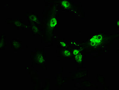 Immunofluorescence staining of U251 cells with the antibody at 1:166, counter-stained with DAPI. The cells were fixed in 4% formaldehyde, permeabilized using 0.2% Triton X-100 and blocked in 10% normal Goat Serum. The cells were then incubated with the antibody overnight at 4°C. The secondary antibody was Alexa Fluor 488-congugated AffiniPure Goat Anti-Rabbit IgG(H+L).Rabbit anti-Human PVALB Polyclonal Antibody