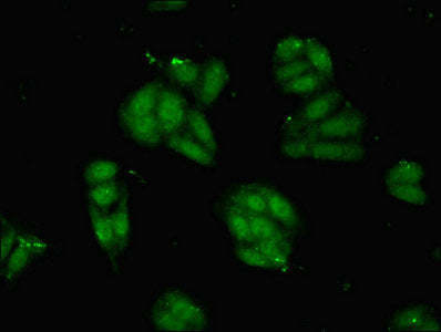 Immunofluorescent analysis of HepG2 cells using PVALB Antibody at dilution of 1:100 and Alexa Fluor 488-congugated AffiniPure Goat Anti-Rabbit IgG(H+L)Rabbit anti-Human PVALB Polyclonal Antibody