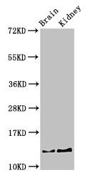 Western Blot  | Positive WB detected in: Mouse brain tissue, Mouse kidney tissue  | All lanes: PVALB antibody at 3µg/ml  | Secondary  | Goat polyclonal to rabbit IgG at 1/50000 dilution  | Predicted band size: 13 kDa  | Observed band size: 13 kDaRabbit anti-Human PVALB Polyclonal Antibody