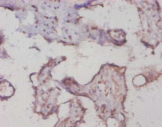 Immunohistochemistry of paraffin-embedded human placenta tissue using PYGL Antibody at dilution of 1:20Rabbit anti-Human PYGL Polyclonal Antibody