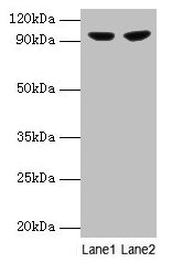 Western blot  | All lanes: PYGL antibody at 2µg/ml  | Lane 1: 293T whole cell lysate  | Lane 2: HepG2 whole cell lysate  | Secondary  | Goat polyclonal to rabbit IgG at 1/10000 dilution  | Predicted band size: 98, 94 kDa  | Observed band size: 98 kDaRabbit anti-Human PYGL Polyclonal Antibody