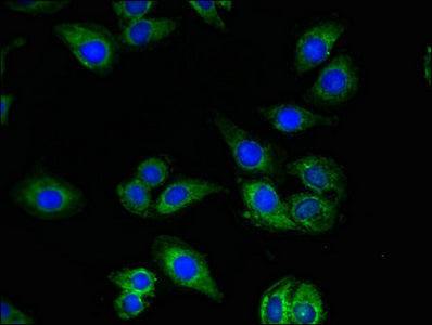 Immunofluorescent analysis of A549 cells using QDPR Antibody at dilution of 1:100 and Alexa Fluor 488-congugated AffiniPure Goat Anti-Rabbit IgG(H+L)Rabbit anti-Human QDPR Polyclonal Antibody