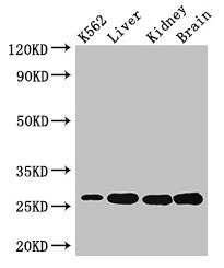 Western Blot  | Positive WB detected in: K562 whole cell lysate, Mouse liver tissue, Mouse kidney tissue, Mouse brain tissue  | All lanes: QDPR antibody at 3µg/ml  | Secondary  | Goat polyclonal to rabbit IgG at 1/50000 dilution  | Predicted band size: 26, 23 kDa  | Observed band size: 26 kDaRabbit anti-Human QDPR Polyclonal Antibody