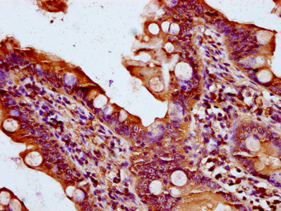 IHC image of QSOX1 Antibody diluted at 1:400 and staining in paraffin-embedded human small intestine tissue performed on a Leica BondTM system. After dewaxing and hydration, antigen retrieval was mediated by high pressure in a citrate buffer (pH 6.0). Section was blocked with 10% normal goat serum 30min at RT. Then primary antibody (1% BSA) was incubated at 4°C overnight. The primary is detected by a biotinylated secondary antibody and visualized using an HRP conjugated SP system.