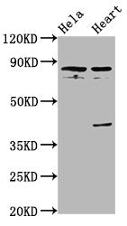 Western Blot | Positive WB detected in: Hela whole cell lysate, Rat heart tissue | All lanes: QSOX1 antibody at 5.6μg/ml | Secondary | Goat polyclonal to rabbit IgG at 1/50000 dilution | Predicted band size: 83 kDa | Observed band size: 83 kDa