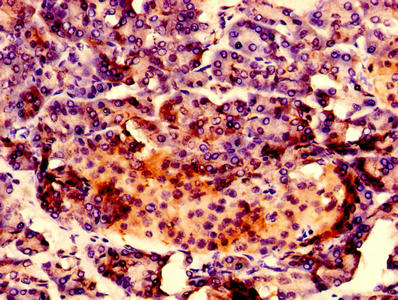 Immunohistochemistry of paraffin-embedded human pancreatic tissue using the antibody at dilution of 1:100Rabbit anti-Human RAB10 Polyclonal Antibody