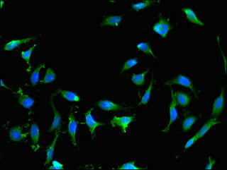 Immunofluorescent analysis of Hela cells using RAB25 Antibody at dilution of 1:100 and Alexa Fluor 488-congugated AffiniPure Goat Anti-Rabbit IgG(H+L)Rabbit anti-Human RAB25 Polyclonal Antibody