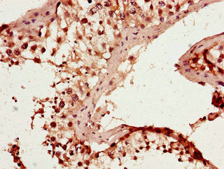 Immunohistochemistry of paraffin-embedded human testis tissue using RAB25 Antibody at dilution of 1:100Rabbit anti-Human RAB25 Polyclonal Antibody