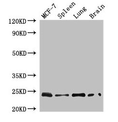 Western Blot  | Positive WB detected in: MCF-7 whole cell lysate, Mouse spleen tissue, Mouse lung tissue, Mouse brain tissue  | All lanes: RAB25 antibody at 4µg/ml  | Secondary  | Goat polyclonal to rabbit IgG at 1/50000 dilution  | Predicted band size: 24 kDa  | Observed band size: 24 kDaRabbit anti-Human RAB25 Polyclonal Antibody
