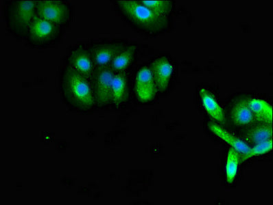 Immunofluorescent analysis of HepG2 cells using RAB27A Antibody at dilution of 1:100 and Alexa Fluor 488-congugated AffiniPure Goat Anti-Rabbit IgG(H+L)Rabbit anti-Human RAB27A Polyclonal Antibody