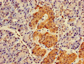 Immunohistochemistry of paraffin-embedded human pancreatic tissue using the antibody at dilution of 1:100Rabbit anti-Human RAB27A Polyclonal Antibody