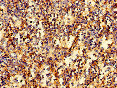 Immunohistochemistry of paraffin-embedded human spleen tissue using RAB27A Antibody at dilution of 1:100Rabbit anti-Human RAB27A Polyclonal Antibody
