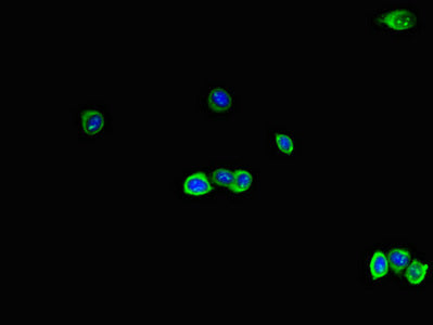 Immunofluorescent analysis of HepG2 cells using RAB28 Antibody at dilution of 1:100 and Alexa Fluor 488-congugated AffiniPure Goat Anti-Rabbit IgG(H+L)Rabbit anti-Human RAB28 Polyclonal Antibody