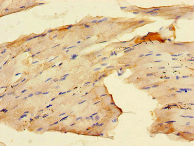 Immunohistochemistry of paraffin-embedded human skeletal muscle tissue using the antibody at dilution of 1:100Rabbit anti-Human RAB28 Polyclonal Antibody
