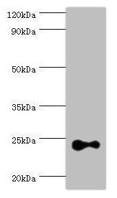 Western blot | All lanes: Ras-related protein Rab-4A antibody at 2μg/ml + Mouse brain tissue | Secondary | Goat polyclonal to rabbit IgG at 1/10000 dilution | Predicted band size: 24 kDa | Observed band size: 24 kDaRabbit anti-Human RAB4A Polyclonal Antibody