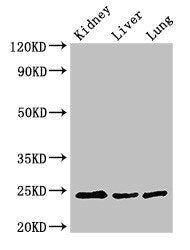 Western Blot | Positive WB detected in: Mouse kidney tissue, Mouse liver tissue, Rat lung tissue | All lanes: RAB5A antibody at 3μg/ml | Secondary | Goat polyclonal to rabbit IgG at 1/50000 dilution | Predicted band size: 24, 23 kDa | Observed band size: 24 kDaRabbit anti-Human RAB5A Polyclonal Antibody