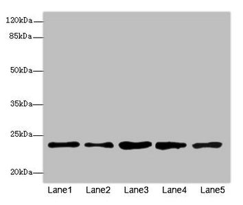 Western blot  | All lanes: RAB9A antibody at 7.66µg/ml  | Lane 1: Jurkat whole cell lysate  | Lane 2: K562 whole cell lysate  | Lane 3: HepG2 whole cell lysate  | Lane 4: 293T whole cell lysate  | Lane 5: Hela whole cell lysate  | Secondary  | Goat polyclonal to rabbit IgG at 1/10000 dilution  | Predicted band size: 23 kDa  | Observed band size: 23 kDaRabbit anti-Human RAB9A Polyclonal Antibody