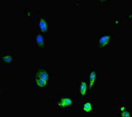 Immunofluorescent analysis of Hela cells using RAD51 Antibody at dilution of 1:100 and Alexa Fluor 488-congugated AffiniPure Goat Anti-Rabbit IgG(H+L)Rabbit anti-Human RAD51 Polyclonal Antibody