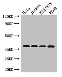Western Blot  | Positive WB detected in: Hela whole cell lysate, Jurkat whole cell lysate, NIH/3T3 whole cell lysate, K562 whole cell lysate  | All lanes: RAD51 antibody at 2.7μg/ml  | Secondary  | Goat polyclonal to rabbit IgG at 1/50000 dilution  | Predicted band size: 37, 27, 32 kDa  | Observed band size: 37 kDaRabbit anti-Human RAD51 Polyclonal Antibody