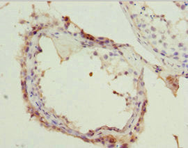Immunohistochemistry of paraffin-embedded human testis tissue using RAE1 Antibody at dilution of 1: 100Rabbit anti-Human RAE1 Polyclonal Antibody