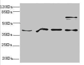 Western blot | All lanes: RAE1 antibody at 4.39μg/ml | Lane 1: Mouse brain tissue | Lane 2: HepG2 whole cell lysate | Lane 3: 293T whole cell lysate | Lane 4: Hela whole cell lysate | Secondary | Goat polyclonal to rabbit IgG at 1/10000 dilution | Predicted band size: 41 kDa | Observed band size: 41, 80 kDaRabbit anti-Human RAE1 Polyclonal Antibody
