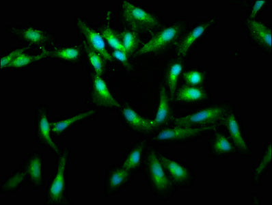 Immunofluorescence staining of Hela cells with RAF1 Antibody at 1:400, counter-stained with DAPI. The cells were fixed in 4% formaldehyde, permeabilized using 0.2% Triton X-100 and blocked in 10% normal Goat Serum. The cells were then incubated with the antibody overnight at 4°C. The secondary antibody was Alexa Fluor 488-congugated AffiniPure Goat Anti-Rabbit IgG(H+L).Rabbit anti-Human RAF1 Polyclonal Antibody